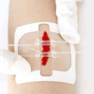 High Quality Class I Lightweight Elastic Medical Tape - Product Image 4