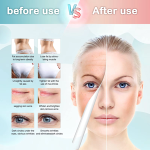 Preço de Fábrica ODM OEM Máquina de Massagem Corporal 40k para Emagrecimento e Modelagem Corporal 6 em 1 - Product Image 4