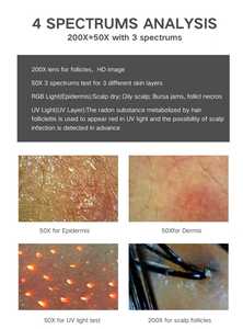 Advanced 11 Inch Trichoscope Camera for Dandruff and Oily Scalp Diagnosis | Clinical Grade Hair Density Tester & Skin Analyzer. - Product Image 5