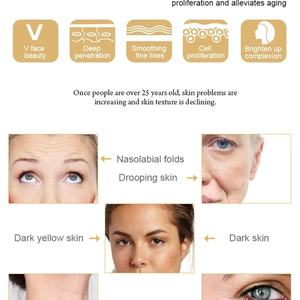 Masajeador Facial Portátil de Microcorriente RF para Reafirmar, Tensar y Rejuvenecer la Piel, Dispositivo de Tratamiento Facial Antienvejecimiento - Product Image 3