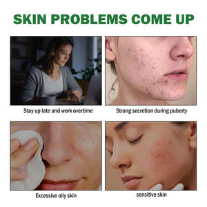 Mascarilla para dormir calmante hidratante más vendida, Gel de Aloe Vera para el cuidado de la piel, crema para después del sol, marca privada - Product Image 3