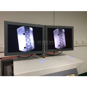 Appareil mobile de radiographie en C SY-D3310C pour salle de radiologie hospitalière avec système d'imagerie radiologique par fluoroscopie pour chirurgie orthopédique - Product Image 3