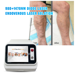 EVLT <strong>Legs</strong> Phlebology Endovenous L Ser <strong>Treatment</strong> <strong>Varicose</strong> <strong>Veins</strong> 980nm1470nm 50W <strong>Varicose</strong> <strong>Veins</strong> Removal Machine - Product Image 1