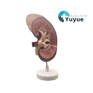 Modelo Anatómico de Riñón con Glándula Adrenal - Herramienta de Enseñanza de Nefrología Desmontable - Product Image 1