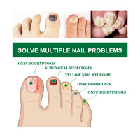 Sérum de traitement fongique des ongles OEM sérum de soin liquide pour la réparation des pieds gel blanchissant pour l'élimination des champignons des ongles des orteils 10ML