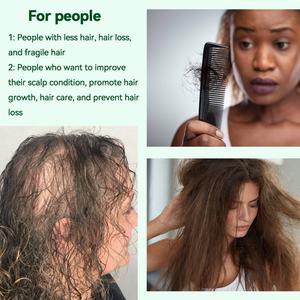 Huile de gingembre biologique pour la croissance des cheveux, réparation nourrissante, croissance rapide des cheveux, anti-pelliculaire, prévention de la perte de cheveux avec des ingrédients à base de plantes - Product Image 2