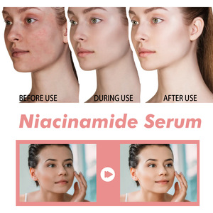 La esencia de niacinamida de melocotón reafirma e hidrata los poros, reduce las marcas de acné, las líneas finas y las manchas, rejuvenece e hidrata. - Product Image 3