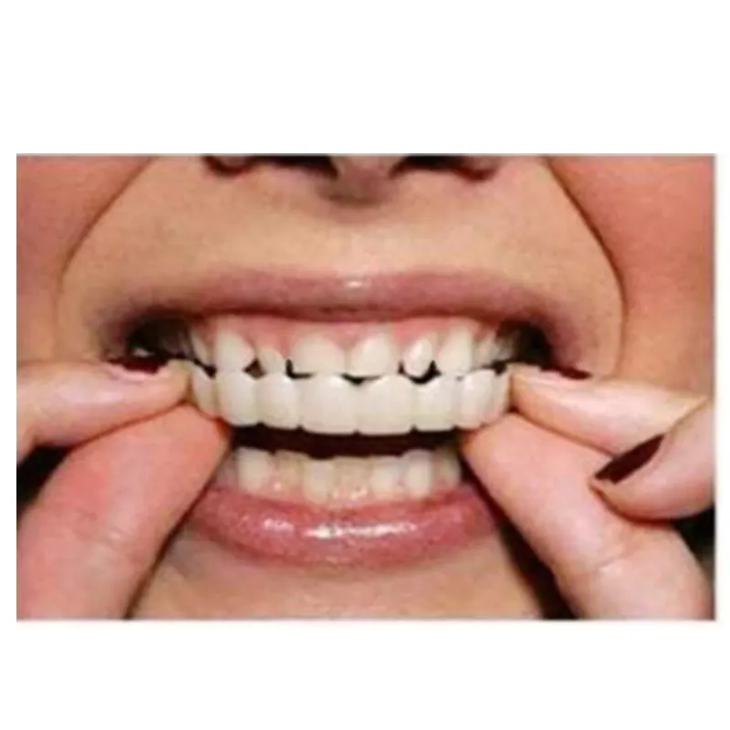 Truelybeauty-tensores de dientes postizos con sonrisa, producto en oferta en Amazon