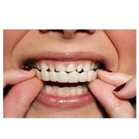 Truelybeauty Amazon sıcak satış mükemmel gülümseme Snap-on parantez yanlış diş kaplamalar yapmak diş yanlış diş diş telleri
