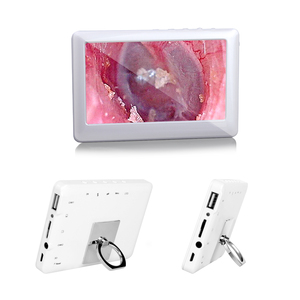 3.9mm Otoscope 1080P 4.3 Inch Screen 6 LED Lights Visual Ear Wax Cleaner Ear <strong>Endoscope</strong> <strong>Camera</strong> - Product Image 1