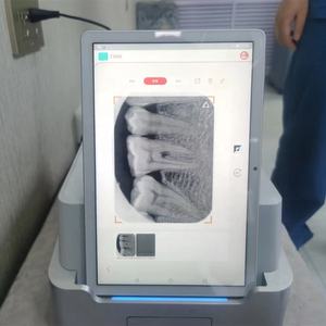 Escáner de Radiografías Dentales TR310, Nuevo Diseño 2022, <span class=keywords><strong>Precio</strong></span> - Product Image 6