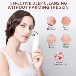 Aspiradora <span class=keywords><strong>Facial</strong></span>, Aparato de Belleza <span class=keywords><strong>para</strong></span> el Hogar, Eliminador de Puntos Negros y Poros Faciales, Cuidado del Acné - Product Image 2