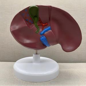 Modèle du Foie et de la Vésicule Biliaire Pathologique - Outil Pédagogique en Hépatologie - Product Image 4