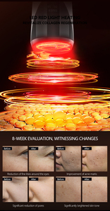 Skin Care Wrinkle Remover Face Lifting Neck Anti Aging LED Light Heating Facial Neck Massage <strong>Machine</strong> - Product Image 2