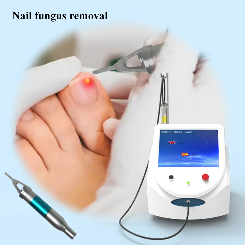 980nm Diode laser Ongle Onychomycose 980nm traitement au laser EVLT Pied clinique utilisation