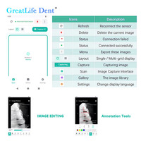 Capteur RVG numérique Greatlife Dent avec écran pour diagnostic immédiat des caries, de la parodontite et des affections radiculaires – Capteur RVG dentaire à écran tablette