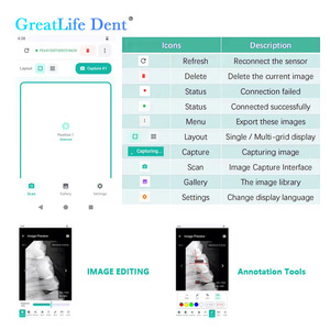 Capteur RVG numérique Greatlife <span class=keywords><strong>Dent</strong></span> avec écran pour diagnostic immédiat des caries, de la parodontite et des affections radiculaires – Capteur RVG dentaire à écran tablette - Product Image 4
