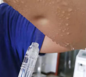 Yüksek basınç 3 memeleri su oksijen jeti Peel kafa cilt bakımı ve saç cilt bakımı için yüksek kaliteli yüz makinesi - Product Image 3