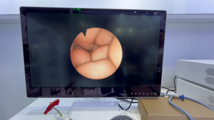 Cámara de Endoscopia FHD IKEDA YKD-9103, Sistema de Artroscopia IKEDA, Cámara Endoscópica Eléctrica de Plástico y Metal para Torre de Artroscopia - Product Image 4