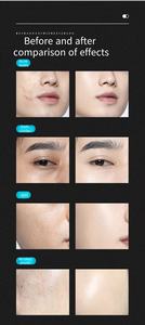 <span class=keywords><strong>Corrector</strong></span> <span class=keywords><strong>de</strong></span> Cobertura Total <span class=keywords><strong>para</strong></span> Hombre OEM/ODM, Acabado Natural Invisible, Cubre Cicatrices <span class=keywords><strong>de</strong></span> Acné, <span class=keywords><strong>Ojeras</strong></span>, <span class=keywords><strong>Corrector</strong></span> Impermeable - Product Image 3