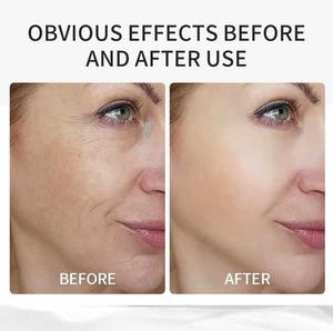 Sérum pour le visage jour-nuit anti-âge VC Ensemble de soins de <span class=keywords><strong>la</strong></span> <span class=keywords><strong>peau</strong></span> pour le visage bio Éclaircissant Clarifier Hydrater Boost Blanchiment GLYCERIN Fade - Product Image 4