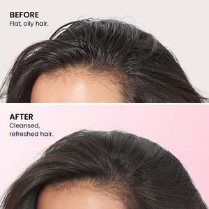 Shampooing Sec Végétalien Herbal Volumisant et Texturisant en Gros pour <span class=keywords><strong>Cheveux</strong></span> Gras – Favorise la Croissance Capillaire et un Coiffage Volumineux pour Hommes et Femmes - Product Image 3