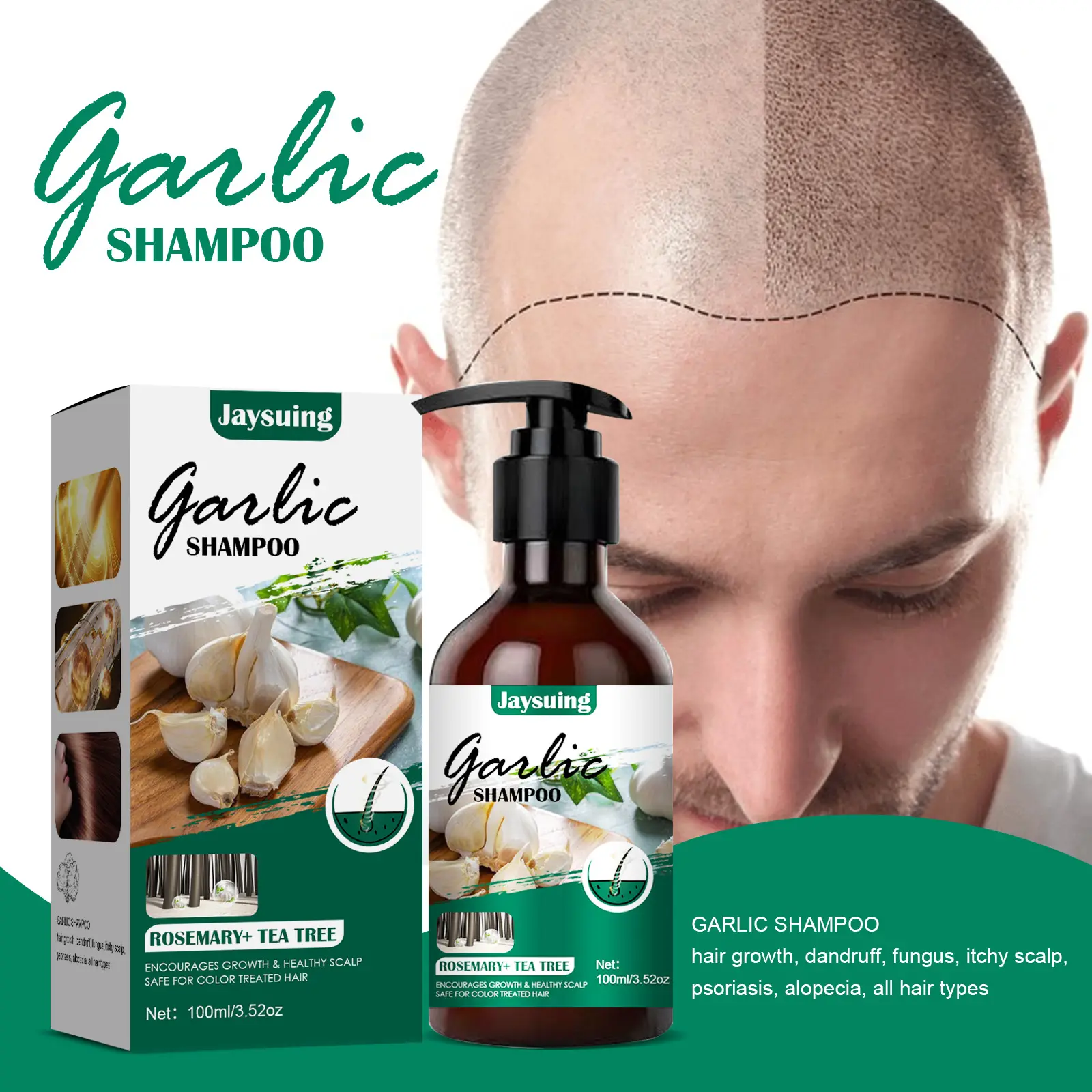 Private label Garlic Shampoo Clean Anti-itch Anti-dandruff Hair Shampoo Growth Anti-Fall Nourishing Hair shampoo