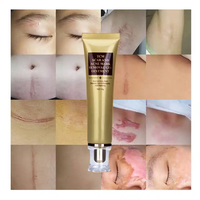 Crème anti-acné et cicatrisante à marque privée, crème pour le visage, crème éclaircissante pour la peau, gel et pommade personnalisés pour l'élimination des cicatrices et de l'acné