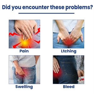 Creme Alívio para Sangramento Anal Inchaço Fissura Anal-Eficaz Hemorróidas Pomada Creme - Product Image 2