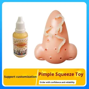 Pimple Popper Toys Nariz Recargable Squeeze Acné Pimple Popping Alivio del estrés Popper Remover Stop Fun Toy - Product Image 6