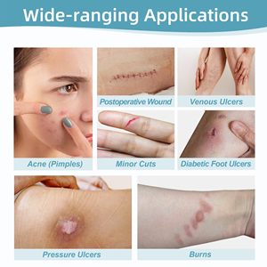 YOJO แผ่นปิดแผลไฮโดรคอลลอยด์แบบม้วน ขนาดและรูปทรงปรับได้ ติดด้วยตัวเอง ผ่านการฆ่าเชื้อ EO สำหรับดูแลบาดแผล แผลไฟไหม้ แผลพุพอง และสิว - Product Image 3