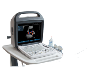 Appareil d'échographie Doppler couleur numérique complet DMU77 avec écran LCD de 15 pouces, instrument de diagnostic médical portable - Product Image 3