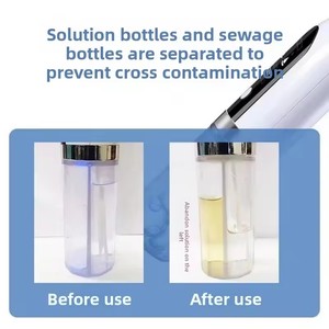 Ofertas de Personalización Rápida al por Mayor, Limpiador de Poros de la Piel, Mini Removedor de Puntos Negros Facial - Product Image 6