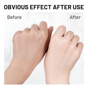 วิตามินซี โพรไบโอติก บอดี้โลชั่น มอยเจอร์ไรเซอร์เพื่อ<span class=keywords><strong>ผิว</strong></span>กระจ่างใส ทุกสภาพผิว ลดจุดด่างดำ ปรับสี<span class=keywords><strong>ผิว</strong></span>ให้สม่ำเสมอ ดูแล<span class=keywords><strong>ผิว</strong></span>ให้เปล่งประกาย - Product Image 5