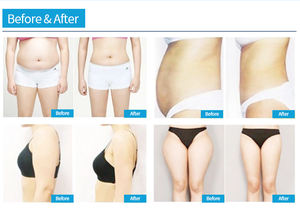 Appareil de massage à micro-vibrations 2-en-1 pour le corps, le lifting du visage et le raffermissement de la peau - Product Image 6