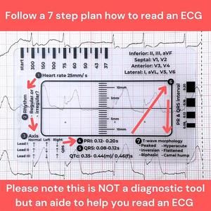 Ecg 7 Step Liniaal Ecg 7 Step Liniaal Voor Interpretatie Ecg Liniaal Kunststof Meetinstrument Transparant Ekg Remklauwen Verpleging Referentie - Product Image 6