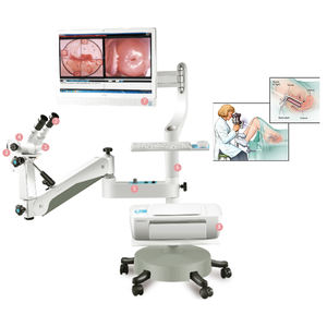 Diskon CE 510K KN-2200BII dikosongkan medis teropong optik endoskopi perangkat colposkop seluler untuk dijual - Product Image 2