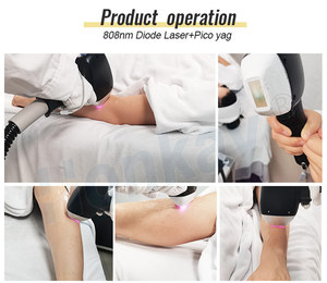 Máquina Depiladora para Mujer, Alta Calidad, Portátil, 808nm, OEM ODM, Belleza y Cuidado Personal, Nueva Tecnología - Product Image 5