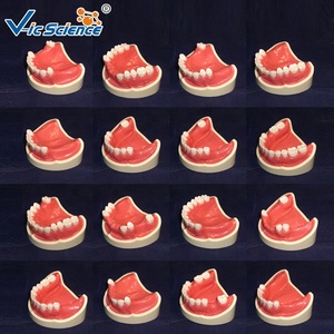Modèle de dents humaines fournitures dentaires modèle manquant de dents avec 32 pièces/ensemble modèle d'éducation des sciences médicales - Product Image 4