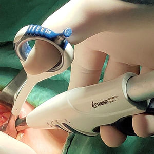 Bisturi elettrico ad ultrasuoni con sistema di bisturi ad ultrasuoni per animali domestici - Product Image 5