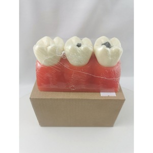 Modelo de dientes M4020 para práctica de caries, herramienta de entrenamiento dental con dientes desmontables - Product Image 1