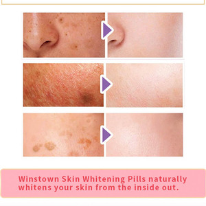 WINS Town เม็ดยาเสริมความงาม, ยาเม็ดกลูตาไธโอเนสกินเพื่อผิวสวยกระจ่างใสสำหรับผิวสีดำ - Product Image 5