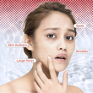 Crème éclaircissante <span class=keywords><strong>pour</strong></span> femmes, utilisation <span class=keywords><strong>de</strong></span> jour, élimine <span class=keywords><strong>les</strong></span> <span class=keywords><strong>taches</strong></span> solaires, <span class=keywords><strong>les</strong></span> <span class=keywords><strong>taches</strong></span> <span class=keywords><strong>de</strong></span> rousseur et la mélanine - Product Image 2