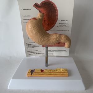 Медицинские науки небольшой размер патологии человека анатомическая модель желудка модели анатомических органов человека - Product Image 6