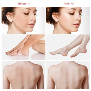 Huile d'arbre à thé purifiante exfoliante et blanchissante pour la peau avec marque privée Gommage propre Vitamine E <span class=keywords><strong>Sel</strong></span> de la mer morte pour le corps - Product Image 4