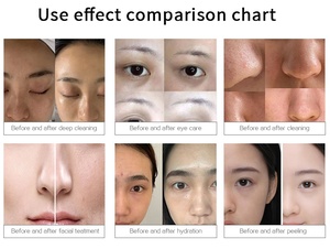 6 1 Diamond Peel Water Dermabrasion Vacuum Hydrating Face Skin Deep Cleansing Beauty <b>Machine</b> US 10.1" Touch Screen Commercial - Product Image 6