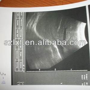 Rouleau de papier thermique haute définition pour imprimante médicale UPP-110HG 110S, papier médical, noyau de papier simple, certifié ISO9001, 110 mm - Product Image 3