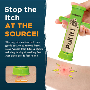Extractor <span class=keywords><strong>de</strong></span> veneno <span class=keywords><strong>de</strong></span> insectos para exteriores, herramienta <span class=keywords><strong>de</strong></span> succión para aliviar la picazón después <span class=keywords><strong>de</strong></span> una picadura <span class=keywords><strong>de</strong></span> mosquitos, dispositivo para curar picaduras <span class=keywords><strong>de</strong></span> insectos. - Product Image 1