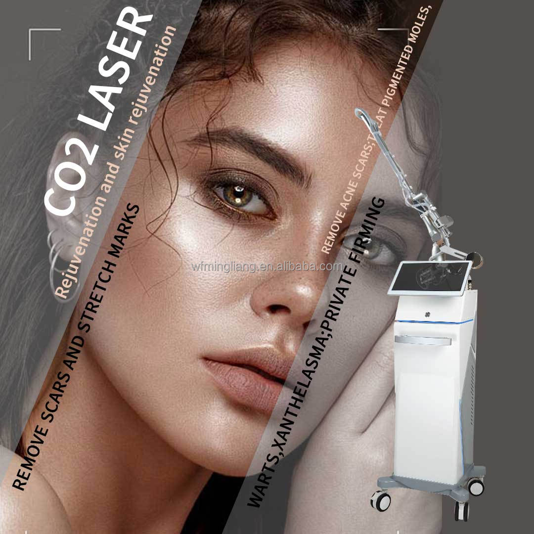 remove tattoo laser machine