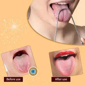 カスタムステンレス鋼舌スクレーパーセット2パックは大人のための口臭口腔衛生歯ケア舌クリーナーを減らします